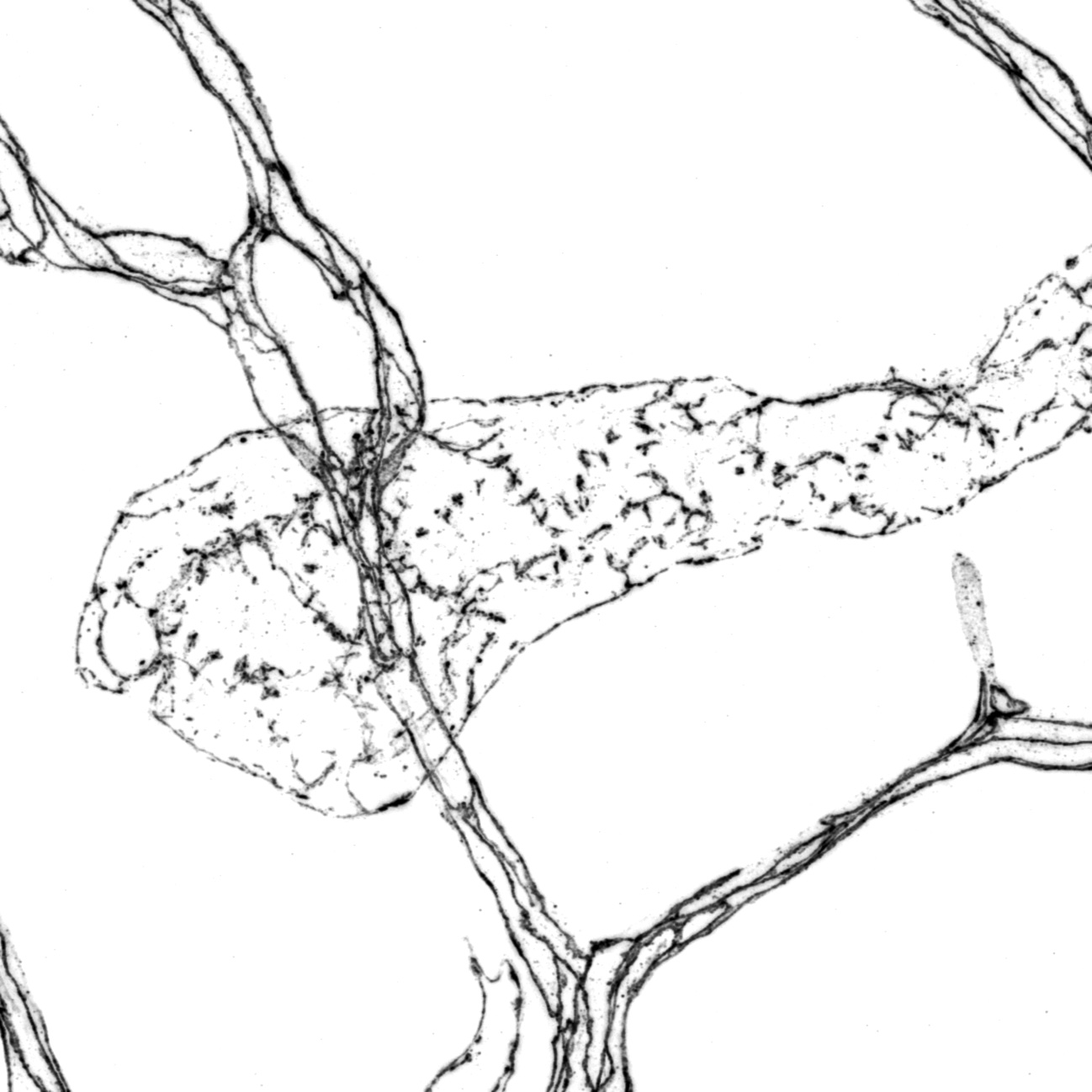 'Button' cell junctions in a lymphatic capillary