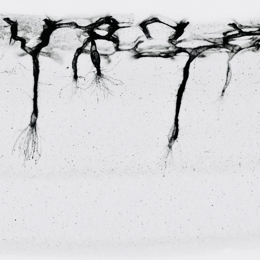 Blood vessels invading the neuroretina at P9