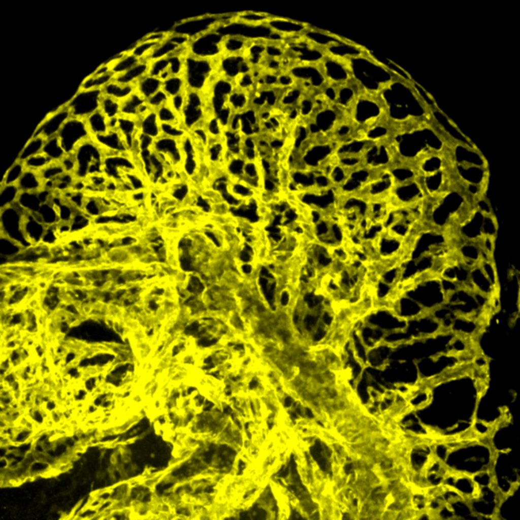 Head vasculature in a E9 mouse embryo